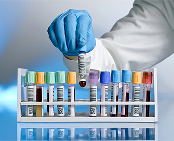 Image of a rack of test tubes of blood samples